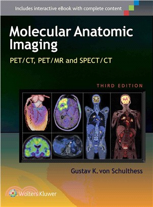 Molecular Anatomic Imaging ─ PET/CT, PET/MR and SPECT/CT