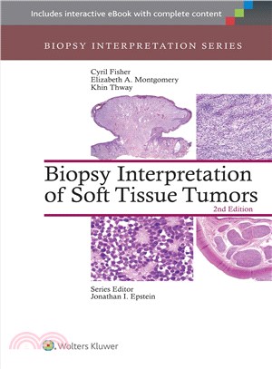 Biopsy interpretation of sof...