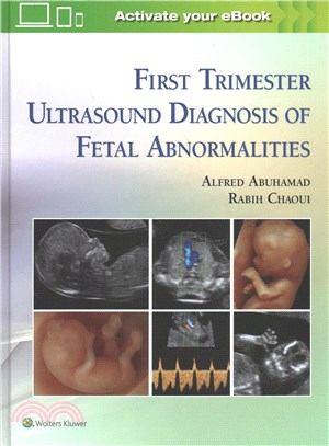 First Trimester Ultrasound Diagnostics of Fetal Abnormalities