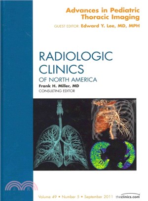 Advances in Pediatric Thoracic Imaging