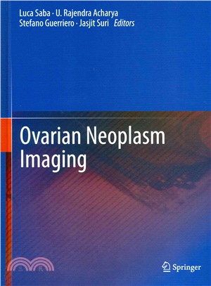 Ovarian Neoplasm Imaging