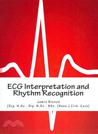 ECG Interpretation and Rhythm Recognition