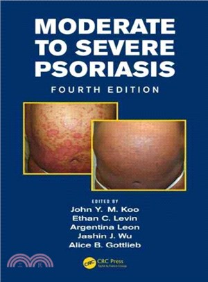 Moderate to Severe Psoriasis