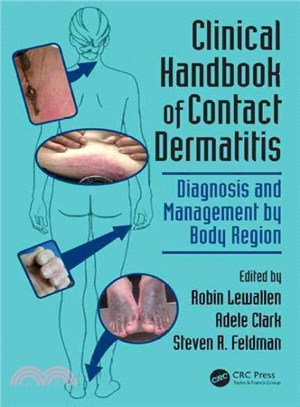 Clinical Handbook of Contact Dermatitis ─ Diagnosis and Management by Body Region