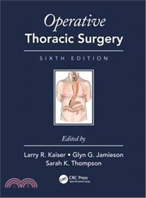 Operative Thoracic Surgery ─ Includes Digital Download