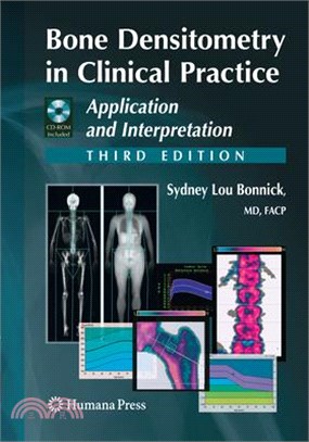 Bone Densitometry in Clinical Practice ― Application and Interpretation