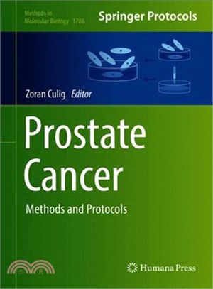 Prostate Cancer ― Methods and Protocols