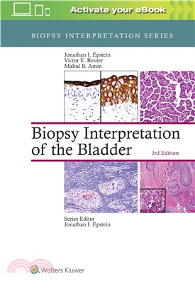 Biopsy interpretation of the...