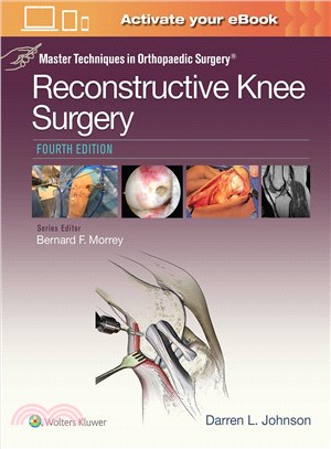 Master Techniques in Orthopaedic Surgery ─ Reconstructive Knee Surgery