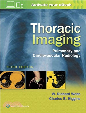 Thoracic Imaging ─ Pulmonary and Cardiovascular Radiology