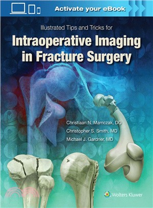 Illustrated Tips and Tricks for Intraoperative Imaging in Fracture Surgery ─ Illustrated Tips and Tricks