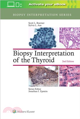 Biopsy interpretation of the...