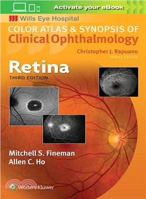 Retina