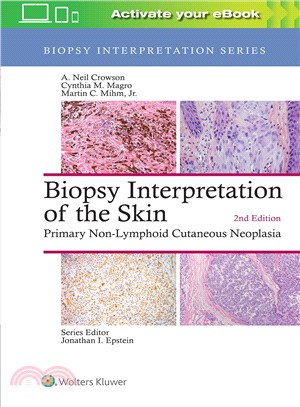 Biopsy interpretation of the...