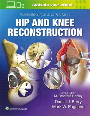 Mayo's Illustrated Tips and Tricks in Hip and Knee Reconstructive and Replacement Surgery
