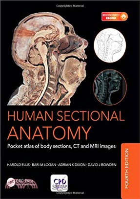 Human Sectional Anatomy ─ Pocket Atlas of Body Sections, CT and MRI Images