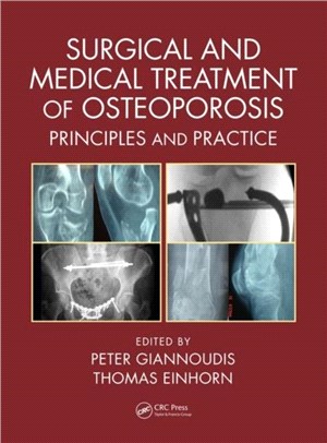 Surgical and Medical Treatment of Osteoporosis：Principles and Practice