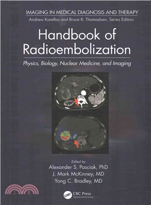 Handbook of radioembolizatio...