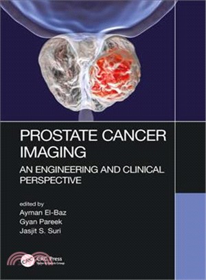 Prostate Cancer Imaging ― An Engineering and Clinical Perspective