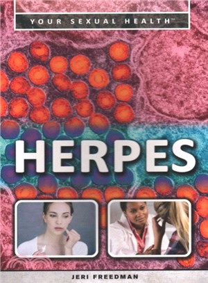 Herpes