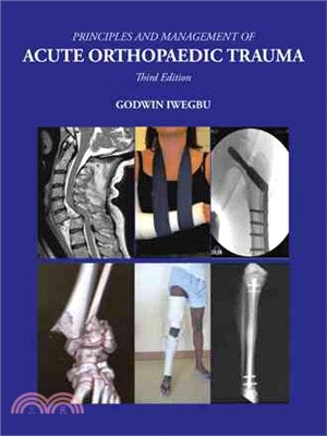 Principles and Management of Acute Orthopaedic Trauma