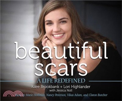 Beautiful Scars ― A Life Redefined