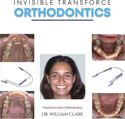 Invisible TransForce Orthodontics