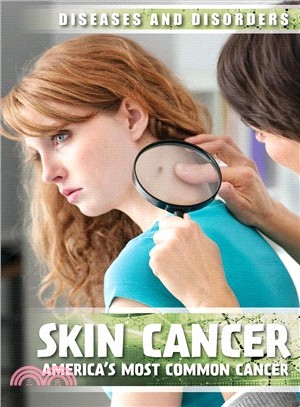 Skin Cancer ― America Most Common Cancer