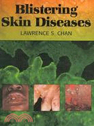 Blistering Skin Diseases