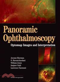 Panoramic Ophthalmosopy—Optomap Images And Interpretation