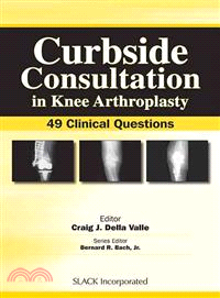 Curbside Consultation in Knee Arthroplasty ─ 49 Clinical Questions