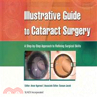 Illustrative Guide to Cataract Surgery: A Step-by-step Approach to Refining Surgical Skills