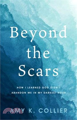 Beyond the Scars: How I Learned God Didn't Abandoned Me in My Darkest Hour