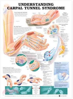 Understanding Carpal Tunnel Syndrome Anatomical Chart