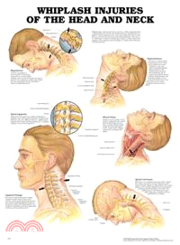 Whiplash Injuries of the Head and Neck Anatomical Chart