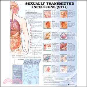 Sexually Transmitted Infections (stis) Chart ─ (unmounted)