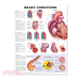 Heart Conditions Anatomical Chart ─ (unmounted)