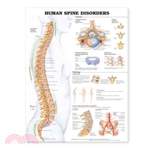 Human Spine Disorders Anatomical Chart