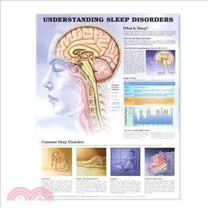 Understanding Sleep Disorders Anatomical Chart