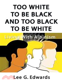 Too White to Be Black and Too Black to Be White ─ Living With Albinism