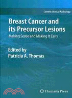 Breast Cancer and Its Precursor Lesions ─ Making Sense and Making It Early