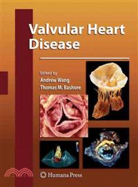 Valvular Heart Disease