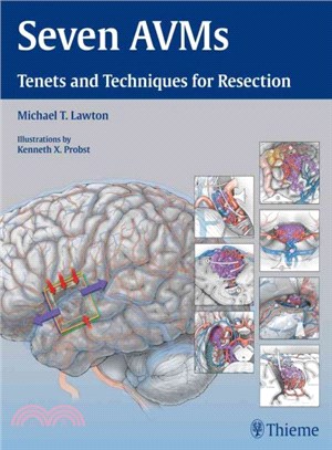 Seven AVMs ― Tenets and Techniques for Resection