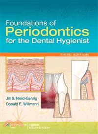 Foundations of Periodontics for the Dental Hygienist