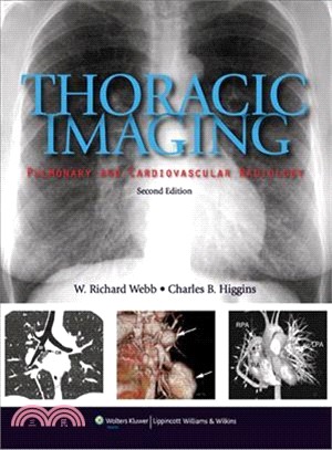 Thoracic Imaging ─ Pulmonary and Cardiovascular Radiology