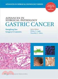 Gastric Cancer: Gastric Cancer