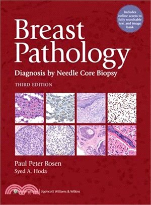 Breast Pathology ─ Diagnosis by Needle Core Biopsy