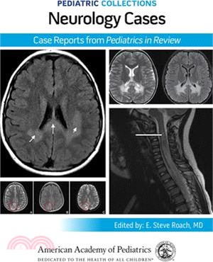 Pediatric Collections: Neurology Cases: Case Reports from Pediatrics in Review