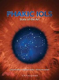 Phakic Iols ─ State of the Art