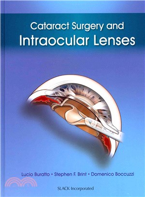 Cataract Surgery and Intraocular Lenses ― Intraocular Lenses